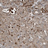 Anti-C9 antibody produced in rabbit Prestige Antibodies® Powered by Atlas Antibodies, affinity isolated antibody, buffered aqueous glycerol solution