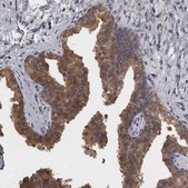 Anti-APRT antibody produced in rabbit Prestige Antibodies® Powered by Atlas Antibodies, affinity isolated antibody, buffered aqueous glycerol solution