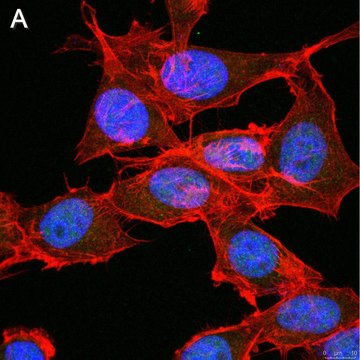 Anti-FoxP3 Antibody, clone 4J2 ZooMAb&#174; Rabbit Monoclonal recombinant, expressed in HEK 293 cells