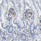 Anti-CLEC10A antibody produced in rabbit Prestige Antibodies® Powered by Atlas Antibodies, affinity isolated antibody, buffered aqueous glycerol solution, Ab1