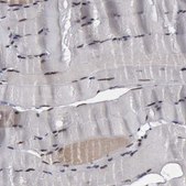 Anti-RTCB antibody produced in rabbit Prestige Antibodies® Powered by Atlas Antibodies, affinity isolated antibody, buffered aqueous glycerol solution