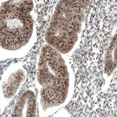 Monoclonal Anti-STAT3 antibody produced in mouse Prestige Antibodies® Powered by Atlas Antibodies, clone CL0492, purified immunoglobulin, buffered aqueous glycerol solution