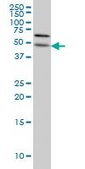 Monoclonal Anti-ALG12 antibody produced in mouse clone 5E3, purified immunoglobulin, buffered aqueous solution