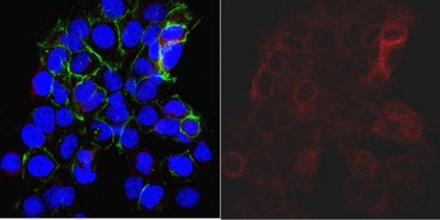 Anti-Derlin-1 Antibody, clone 8G11.2 clone 8G11.2, from mouse