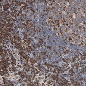 Anti-SH3KBP1 antibody produced in rabbit Ab2, Prestige Antibodies® Powered by Atlas Antibodies, affinity isolated antibody, buffered aqueous glycerol solution