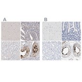 Anti-ACTL7B antibody produced in rabbit Prestige Antibodies® Powered by Atlas Antibodies, affinity isolated antibody, buffered aqueous glycerol solution, Ab2