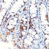 Anti-CDX2 antibody produced in rabbit