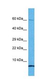 Anti-C1ORF151 antibody produced in rabbit affinity isolated antibody