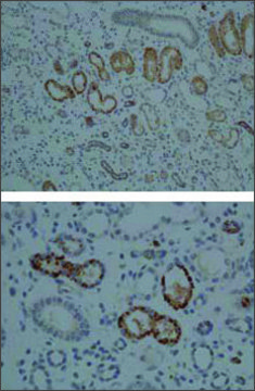 Anti-CYP1A1 (AB2) affinity isolated antibody