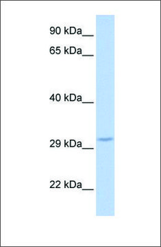 Anti-FBXO27 antibody produced in rabbit affinity isolated antibody