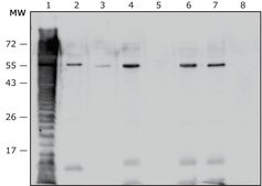 Anti- Proteus vulgaris antibody produced in rabbit IgG fraction of antiserum