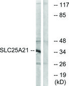Anti-SLC25A21 antibody produced in rabbit affinity isolated antibody