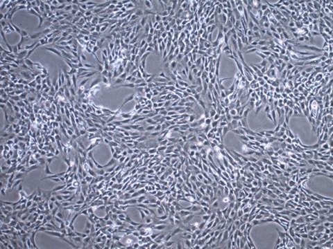 C20A4 Human Chondrocyte Cell Line C20A4 Human Chondrocyte Cell Line is widely used as a model cell line for studying normal and pathological cartilage repair mechanisms related to chondrocyte biology and physiology.