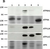 Anti-ATP11A antibody produced in rabbit Prestige Antibodies® Powered by Atlas Antibodies, affinity isolated antibody, buffered aqueous glycerol solution
