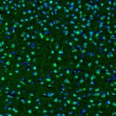 Anti-OGFOD1 antibody produced in rabbit Prestige Antibodies® Powered by Atlas Antibodies, affinity isolated antibody, buffered aqueous glycerol solution