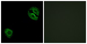 Anti-Collagen XIX α1 antibody produced in rabbit affinity isolated antibody