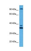 Anti-ZFX, (N-terminal) antibody produced in rabbit affinity isolated antibody