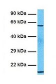 Anti-ARID5A (ab2) antibody produced in rabbit affinity isolated antibody