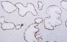 p63 (EP174) Rabbit Monoclonal Primary Antibody