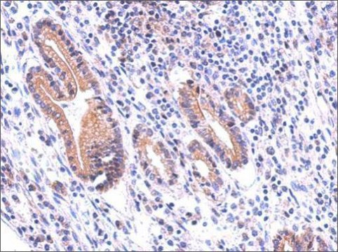 Anti-DUOX1 antibody produced in rabbit affinity isolated antibody, buffered aqueous solution