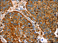 Anti-SLC27A5 affinity isolated antibody