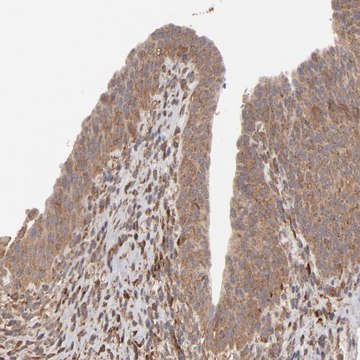 Anti-MMP2 antibody produced in rabbit Prestige Antibodies&#174; Powered by Atlas Antibodies, affinity isolated antibody, buffered aqueous glycerol solution