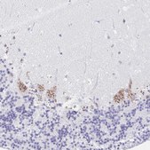 Anti-SULT1B1 antibody produced in rabbit Prestige Antibodies® Powered by Atlas Antibodies, affinity isolated antibody, buffered aqueous glycerol solution