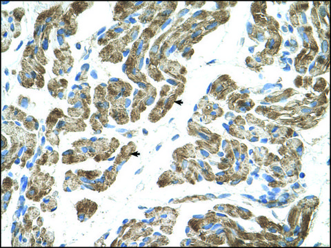 Anti-ACVR1 affinity isolated antibody