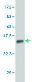Monoclonal Anti-DOT1L antibody produced in mouse clone 6A6, purified immunoglobulin, buffered aqueous solution