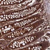 Anti-RPUSD1 antibody produced in rabbit Prestige Antibodies® Powered by Atlas Antibodies, affinity isolated antibody, buffered aqueous glycerol solution