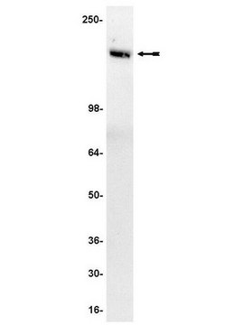 Anti-Tie2/TEK Antibody, clone Ab33 clone Ab33, Upstate&#174;, from mouse