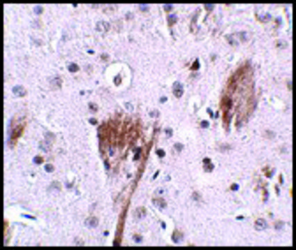 Anti-SPG11 antibody produced in rabbit affinity isolated antibody, buffered aqueous solution