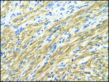 Anti-MBNL1 (AB1) antibody produced in rabbit affinity isolated antibody