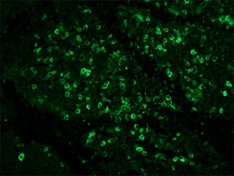 Anti-Human IgG (whole molecule) antibody produced in rabbit whole antiserum