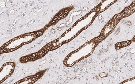 Anti-Raf-1 Antibody, clone 1I3 ZooMAb® Rabbit Monoclonal recombinant, expressed in HEK 293 cells