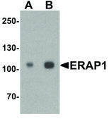 Anti-ERAP1 antibody produced in rabbit affinity isolated antibody