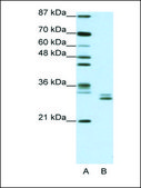 Anti-CLIC5 antibody produced in rabbit affinity isolated antibody