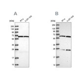 Anti-ACAD9 antibody produced in rabbit Prestige Antibodies® Powered by Atlas Antibodies, affinity isolated antibody, buffered aqueous glycerol solution