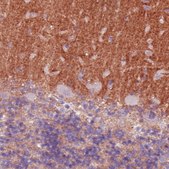 Monoclonal Anti-TSPAN7 antibody produced in mouse Prestige Antibodies® Powered by Atlas Antibodies, clone CL0262, purified immunoglobulin, buffered aqueous glycerol solution