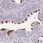 Anti-TMEM237 antibody produced in rabbit Prestige Antibodies® Powered by Atlas Antibodies, affinity isolated antibody, buffered aqueous glycerol solution