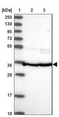 Anti-FKBP8 antibody produced in rabbit Prestige Antibodies® Powered by Atlas Antibodies, affinity isolated antibody, buffered aqueous glycerol solution