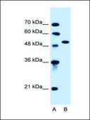 Anti-ACVR1 affinity isolated antibody
