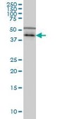 Monoclonal Anti-CSNK1G1 antibody produced in mouse clone 3D1, purified immunoglobulin, buffered aqueous solution