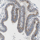 Anti-PIK3CA antibody produced in rabbit Prestige Antibodies® Powered by Atlas Antibodies, affinity isolated antibody, buffered aqueous glycerol solution