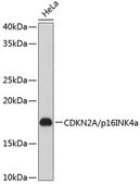 Anti- CDKN2A/p16INK4a antibody produced in rabbit