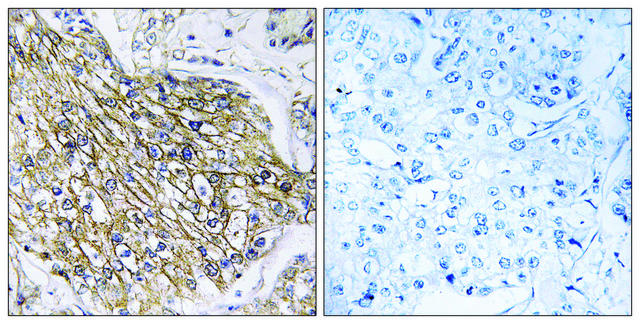 Anti-LPHN2 antibody produced in rabbit affinity isolated antibody