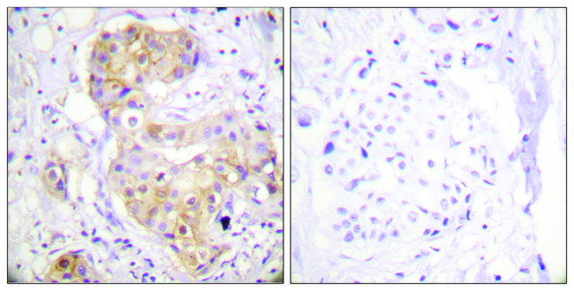 Anti-PKC &#948; antibody produced in rabbit affinity isolated antibody