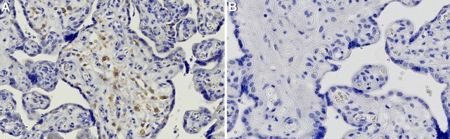 Anti-DKK1 Antibody, clone 1N16 ZooMAb&#174; Rabbit Monoclonal recombinant, expressed in HEK 293 cells