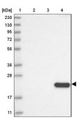 Anti-CLEC3B antibody produced in rabbit Prestige Antibodies® Powered by Atlas Antibodies, affinity isolated antibody, buffered aqueous glycerol solution