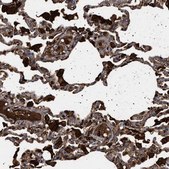 Anti-FICD antibody produced in rabbit Prestige Antibodies® Powered by Atlas Antibodies, affinity isolated antibody, buffered aqueous glycerol solution